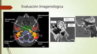 Evaluación Imagenologica
 