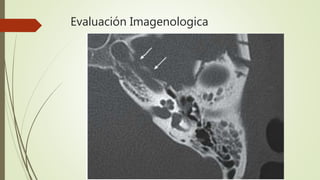 Evaluación Imagenologica
 