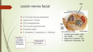 Lesión nervio facial
 6-7 % de las fracturas temporales
 Latencia de 1- 16 dias
 27% inmediatamente
 73% ocurren posteriormente
 Pronostico pobre
 1.- Inmediato, 2.-penetrante, 3.- Infección
Parálisis
completa +
Aparición
inmediata
Exploración
quirúrgica
66%
• Ganglio geniculado…66%
• 2da rodilla ……………20%
• Segmento timpánico…8%
• Segmento mastoideo…6%
 
