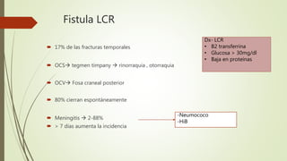 Fistula LCR
 17% de las fracturas temporales
 OCS tegmen timpany  rinorraquia , otorraquia
 OCV Fosa craneal posterior
 80% cierran espontáneamente
 Meningitis  2-88%
 > 7 días aumenta la incidencia
Dx- LCR
• B2 transferrina
• Glucosa > 30mg/dl
• Baja en proteínas
-Neumococo
-HiB
 