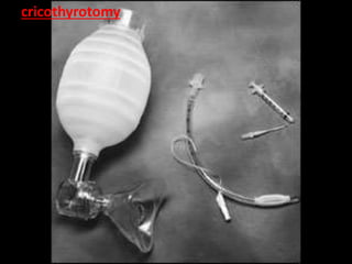 Transcricothyroid Injection TRAUMA THORAKS DR TAW RSPAD1.ppt