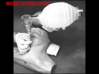 Transcricothyroid Injection TRAUMA THORAKS DR TAW RSPAD1.ppt