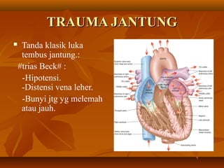 TRAUMA JANTUNG


Tanda klasik luka
tembus jantung.:
#trias Beck# :
-Hipotensi.
-Distensi vena leher.
-Bunyi jtg yg melemah
atau jauh.

 