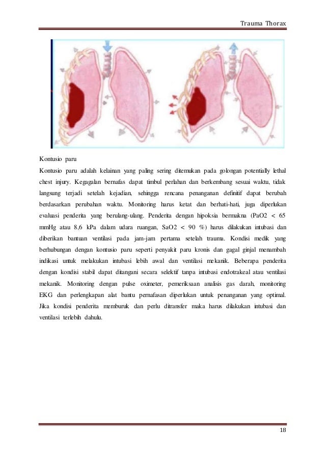 TRAUMA THORAX ADALAH PDF TRAUMA THORAX ADALAH PDF