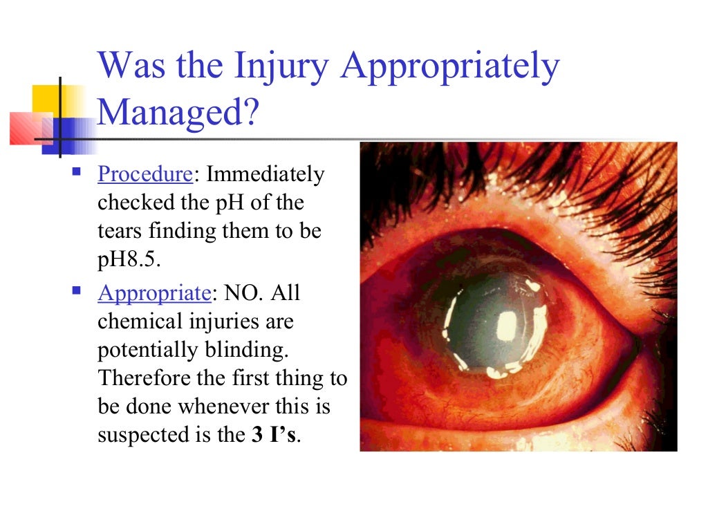Traumatic eye injury hypothetical case presentaion