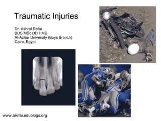 Traumatic Injuries
Dr. Ashraf Refai
BDS MSc DD HMD
Al-Azhar University (Boys Branch)
Cairo, Egypt
www.arefai.edublogs.org
 