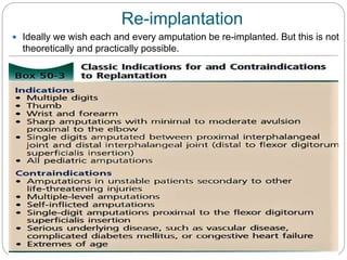 Re-implantation
 Ideally we wish each and every amputation be re-implanted. But this is not
theoretically and practically possible.
 