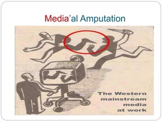 Media’al Amputation
 
