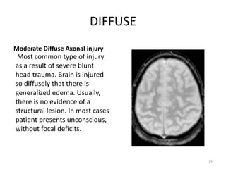 DIFFUSE
Moderate Diffuse Axonal injury
Most common type of injury
as a result of severe blunt
head trauma. Brain is injured
so diffusely that there is
generalized edema. Usually,
there is no evidence of a
structural lesion. In most cases
patient presents unconscious,
without focal deficits.
29
 