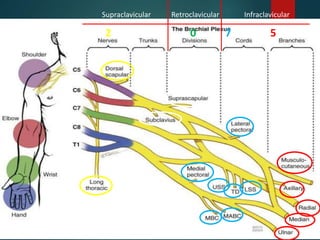 2 2 0 7 5
Supraclavicular Retroclavicular Infraclavicular
 