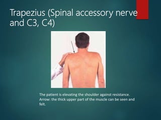 Trapezius (Spinal accessory nerve
and C3, C4)
The patient is elevating the shoulder against resistance.
Arrow: the thick upper part of the muscle can be seen and
felt.
 