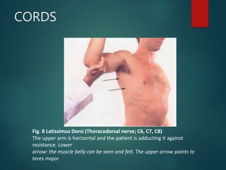 CORDS
Fig. 8 Latissimus Dorsi (Thoracodorsal nerve; C6, C7, C8)
The upper arm is horizontal and the patient is adducting it against
resistance. Lower
arrow: the muscle belly can be seen and felt. The upper arrow points to
teres major.
 