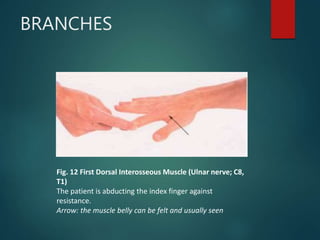 BRANCHES
Fig. 12 First Dorsal Interosseous Muscle (Ulnar nerve; C8,
T1)
The patient is abducting the index finger against
resistance.
Arrow: the muscle belly can be felt and usually seen
 