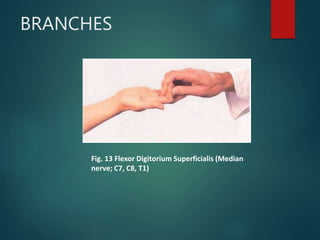 BRANCHES
Fig. 13 Flexor Digitorium Superficialis (Median
nerve; C7, C8, T1)
 