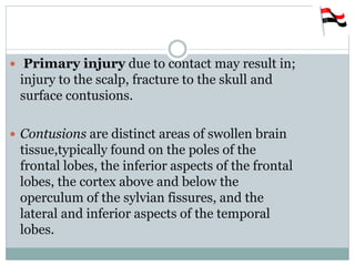 Primary Injury Traumatic brain injury | PPTX