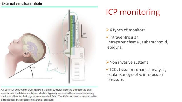 Traumatic brain injury - Neurological perspective