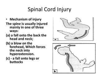 Spinal Cord Injury
• Mechanism of injury
The spine is usually injured
mainly in one of three
ways:
(a) a fall onto the back the
head and neck;
(b) a blow on the
forehead, Which forces
the neck into
hyperextension.
(c) - a fall onto legs or
buttocks
 