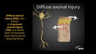 Traumatic Brain Injury radiological imaging | PPTX