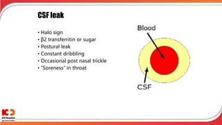 CSF leak
• Halo sign
• β2 transferritin or sugar
• Postural leak
• Constant dribbling
• Occasional post nasal trickle
• “Soreness” in throat
 