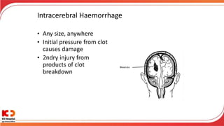 Intracerebral Haemorrhage
• Any size, anywhere
• Initial pressure from clot
causes damage
• 2ndry injury from
products of clot
breakdown
 