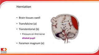 Herniation
• Brain tissues swell
• Transfalcine (a)
• Transtentorial (b)
• Pressure on IIIrd nerve
dilated pupil
• Foramen magnum (e)
 