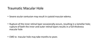 Traumatic Macular Hole
• Severe ocular contusion may result in cystoid macular edema.
• Rupture of the inner retinal layer occasionally occurs, resulting in a lamellar hole;
rupture of both the inner and outer retinal layers results in a full-thickness
macular hole
• CME to macular hole may take months to years
 