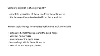 Complete avulsion is characterized by
• complete separation of the retina from the optic nerve,
• the lamina cribrosa is retracted from the scleral rim.
Funduscopic findings in complete optic nerve avulsion include
• extensive hemorrhages around the optic nerve
• vitreous hemorrhage
• excavation of the optic nerve
• hemorrhage within the optic nerve
• central retinal artery occlusion
 