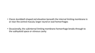 • Classic dumbbell-shaped red elevation beneath the internal limiting membrane in
or near the central macula; larger round or oval hemorrhages
• Occasionally, the subinternal limiting membrane hemorrhage breaks through to
the subhyaloid space or vitreous cavity
 