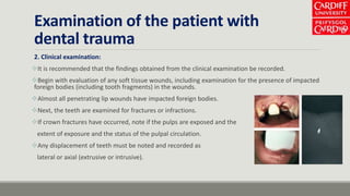 Infraction Tooth Traumatic dental injuries | PPTX