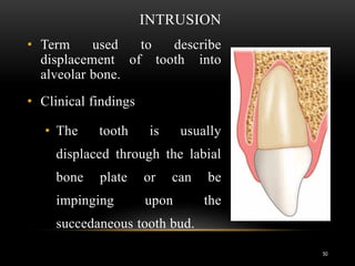 Traumatic dental injuries | PPT