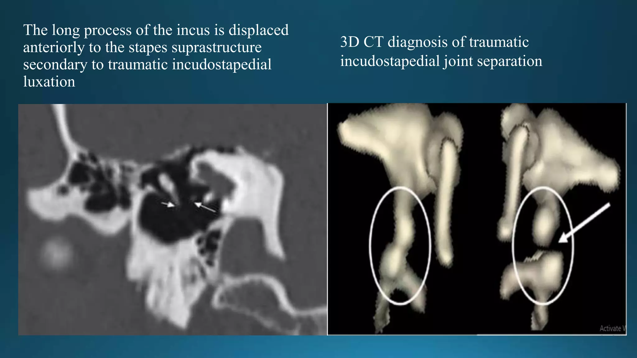 Traumatic ear | PPTX