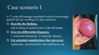 Case scenario I
A 17-year-old teenager presented with an increasingly
painful left ear swelling of 2 days duration.
1) Describe the findings.
red swelling of superior part of the left pinna
2) Give two differential .
1-Auricular hematoma 2-Auricular abscess
3) List potential complications that can occur.
septicemia , perichondritis and cauliflower ear.
 