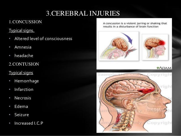Traumatic Head And Spinal Cord Injury