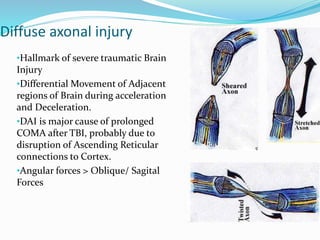 Traumatic head injury | PPTX