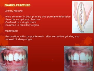 Enamel Infarctions Traumatic injuries | PPTX