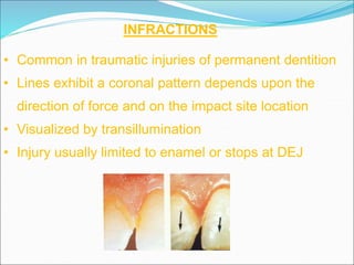 Enamel Infarctions TRAUMATIC INJURIES TO THE TEETH AND SUPPORTING STRUCTURES | PPT