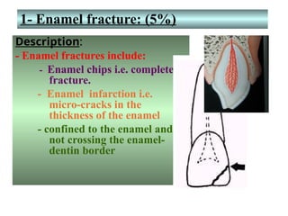 Enamel Infarctions traumatic injuries childhoodperiods in chil | PPT
