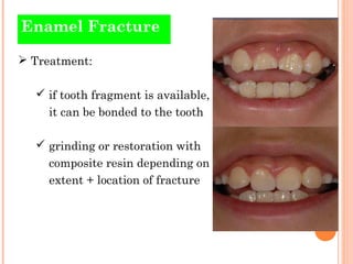 Traumatic injuries of teeth | PPT