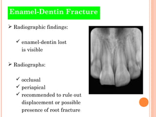 Enamel Infarctions Traumatic injuries of teeth | PPT