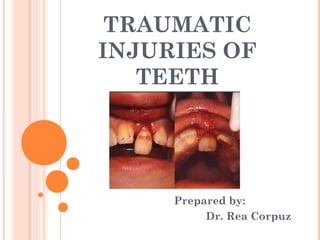 TRAUMATIC
INJURIES OF
   TEETH




     Prepared by:
          Dr. Rea Corpuz
 
