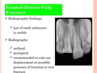 Enamel-Dentin-Pulp
Fracture
 Radiographic findings:

    lost of tooth substance
     is visible

 Radiographs:

    o...