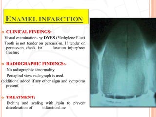 Infraction Tooth Traumatic injuries of teeth | PPTX