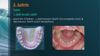 Permanent Splints Traumatic injuries of the face and jaws | PPT