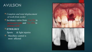 TRAUMATIC INJURIES TO ANTERIOR face of the body.pptx