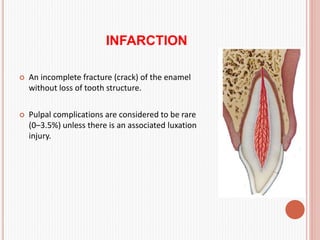 Infraction Tooth Traumatic Injuries to Teeth.pptx