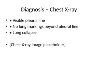 Diagnosis – Chest X-ray
• • Visible pleural line
• • No lung markings beyond pleural line
• • Lung collapse
• [Chest X-ray image placeholder]
 