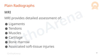 OrthoArena
Plain Radiographs
MRI
MRI provides detailed assessment of:
● Ligaments
● Tendons
● Muscles
● Cartilage
● Bone marrow
● Associated soft-tissue injuries
51
 