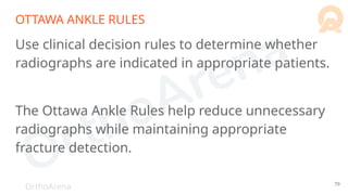 OrthoArena
OTTAWA ANKLE RULES
Use clinical decision rules to determine whether
radiographs are indicated in appropriate patients.
The Ottawa Ankle Rules help reduce unnecessary
radiographs while maintaining appropriate
fracture detection.
79
 
