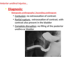 Retrograde Urethrogram Rupture Traumatic Urological Emergencies - Differential Diagnosis | PPTX