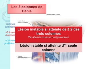 •Colonne
antérieure
•Colonne
moyenne
•Colonne
postérieure
Les 3 colonnes de
Denis
Lésion instable si atteinte de ≥ 2 des
trois colonnes
Par atteinte osseuse ou ligamentaire
Lésion stable si atteinte d’1 seule
colonne
 